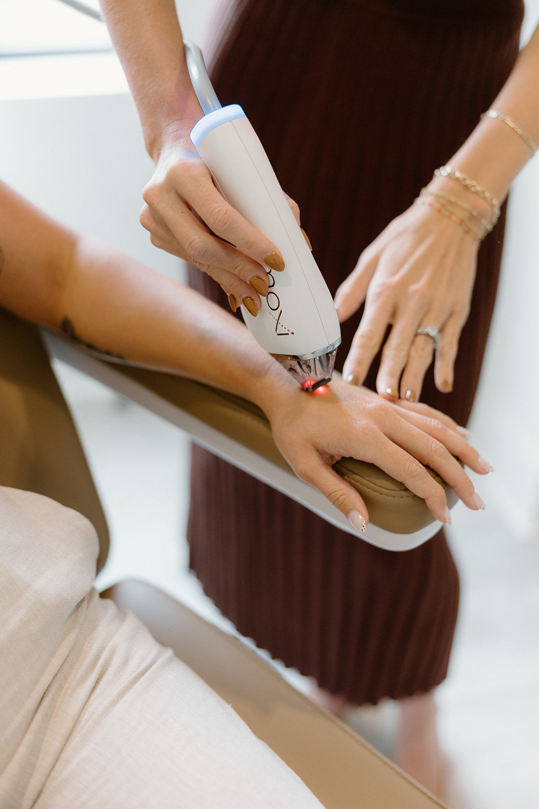 Sciton Moxi results  in Wilmington NC