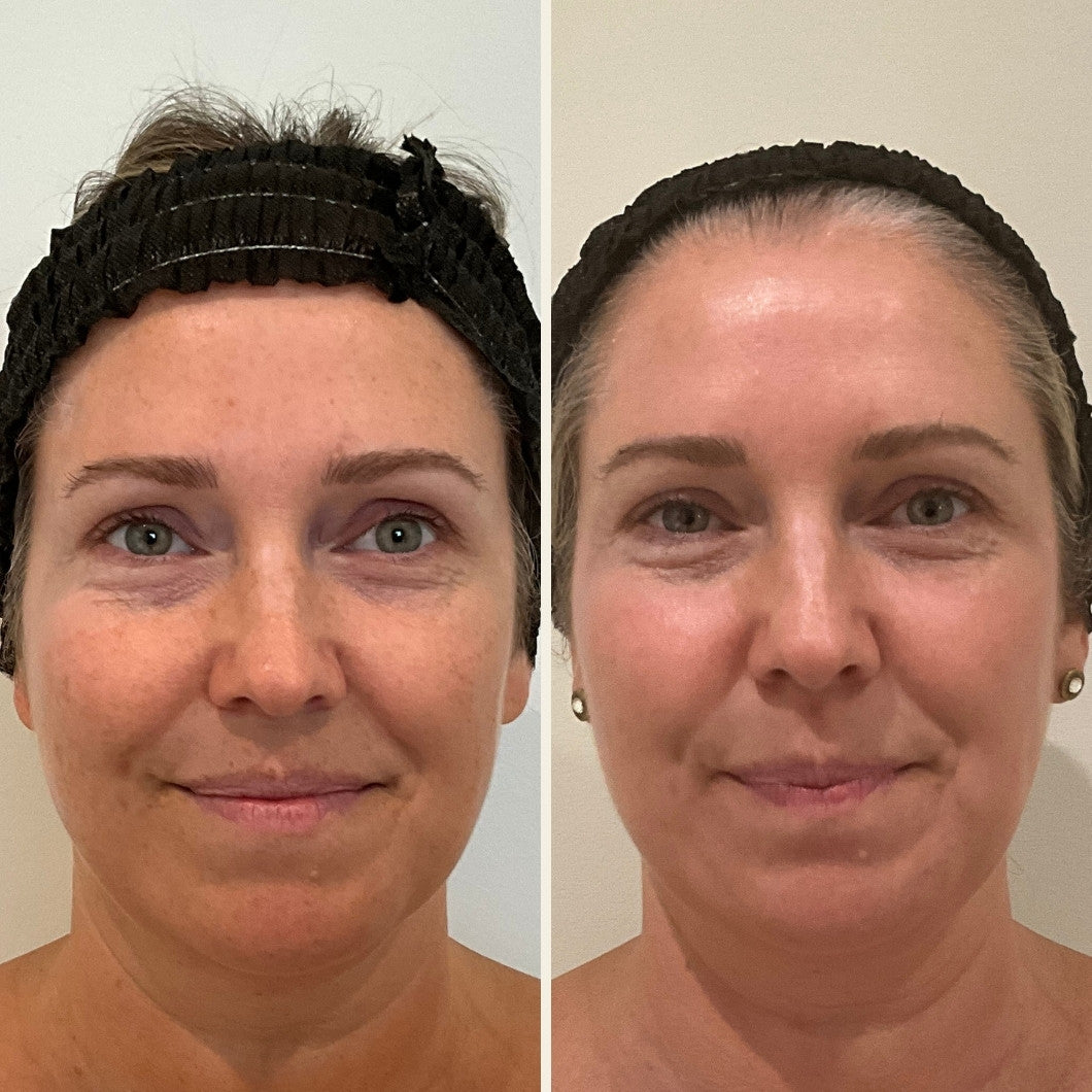 BBL Heroic results in Wilmington, NC